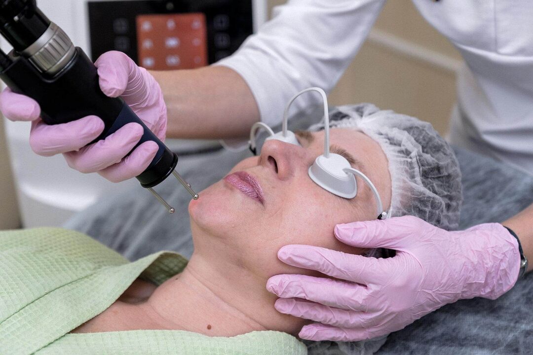 Procedura laser ablativa per il ringiovanimento della pelle
