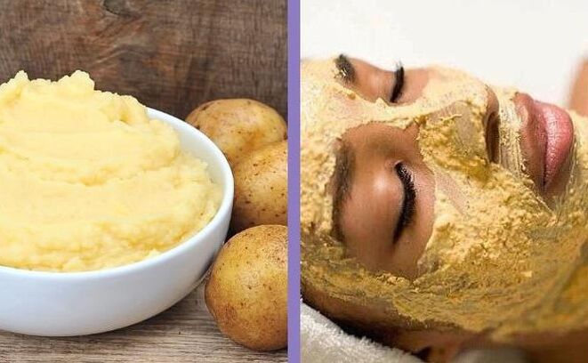 Maschera di patate