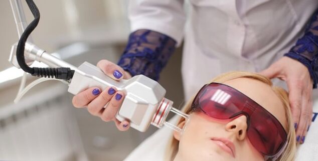 Il principio di ringiovanimento del viso con un laser